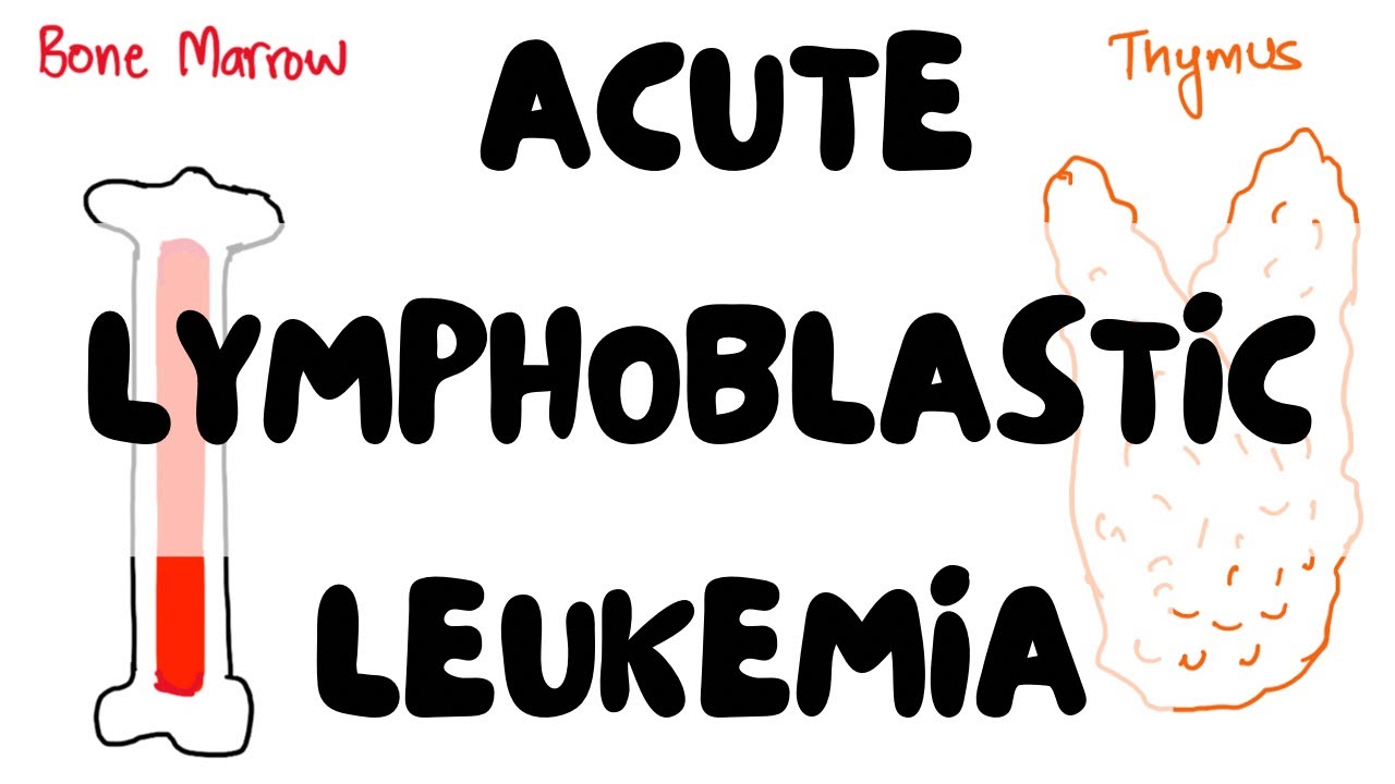 Acute Lymphoblastic Leukemia in under 20 Minutes | Pathology | Lectures by Omer