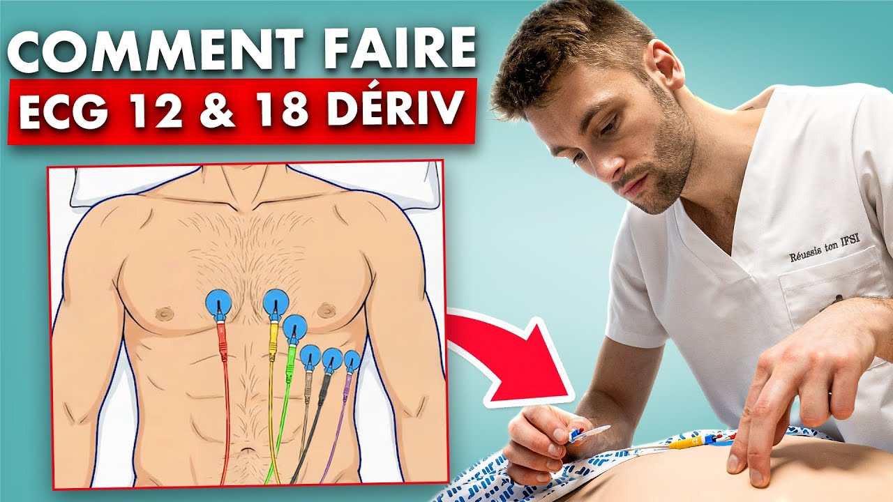 ECG : placement des électrodes 12 et 18 dérivations - soin infirmier