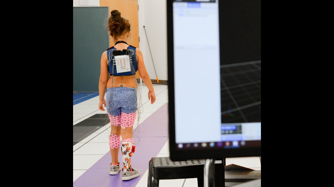 Shriners Children's Motion Analysis Center Webinar