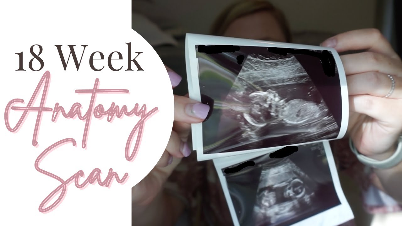 18 Week Anatomy Scan!