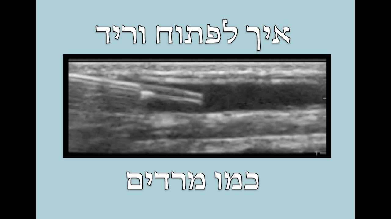 איך לפתוח וריד כמו מרדים