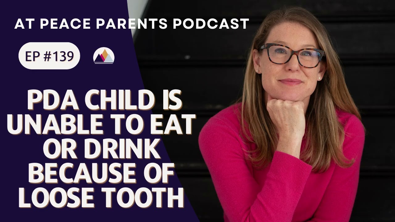 PDA Child Is Unable To Eat Or Drink Because Of Loose Tooth