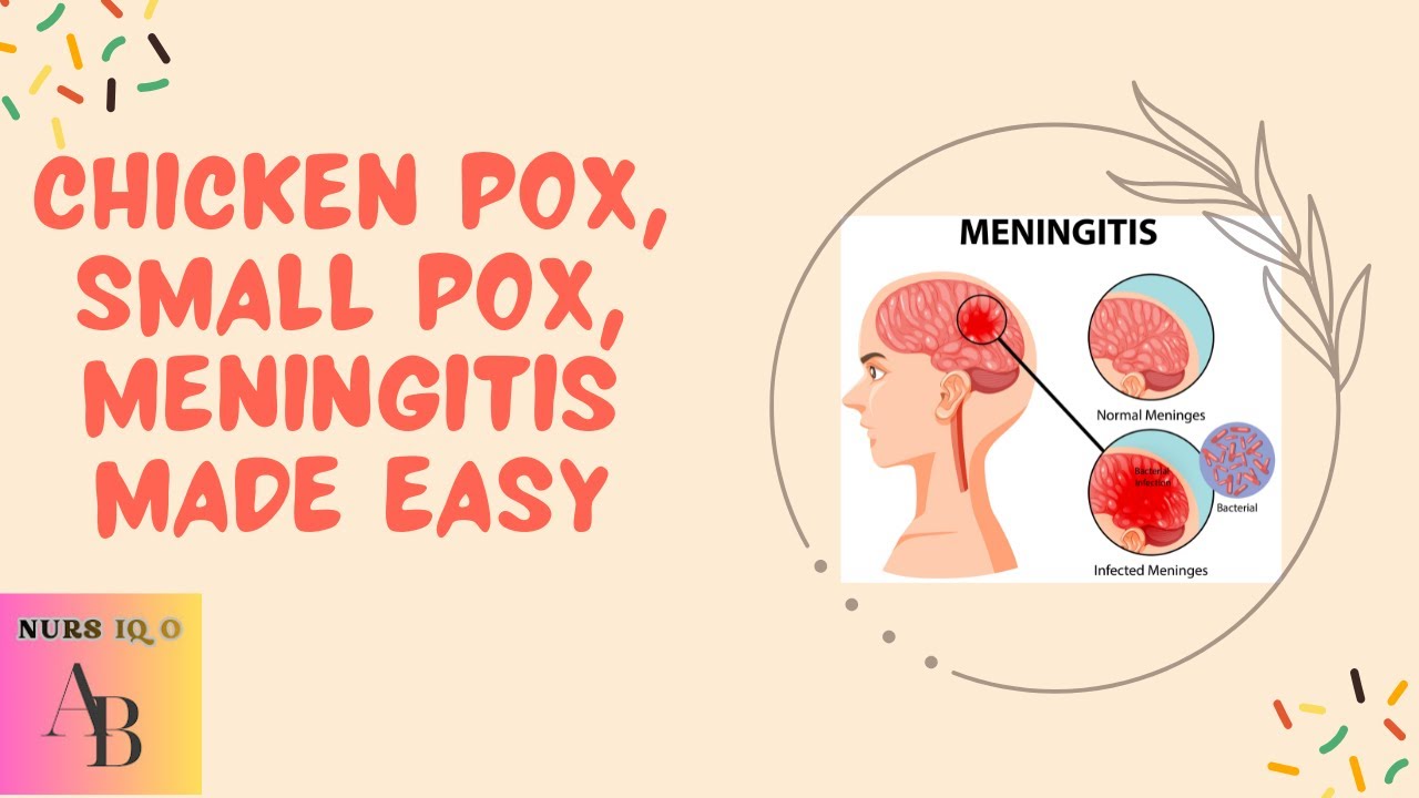 Small pox, Chicken pox and Meningitis