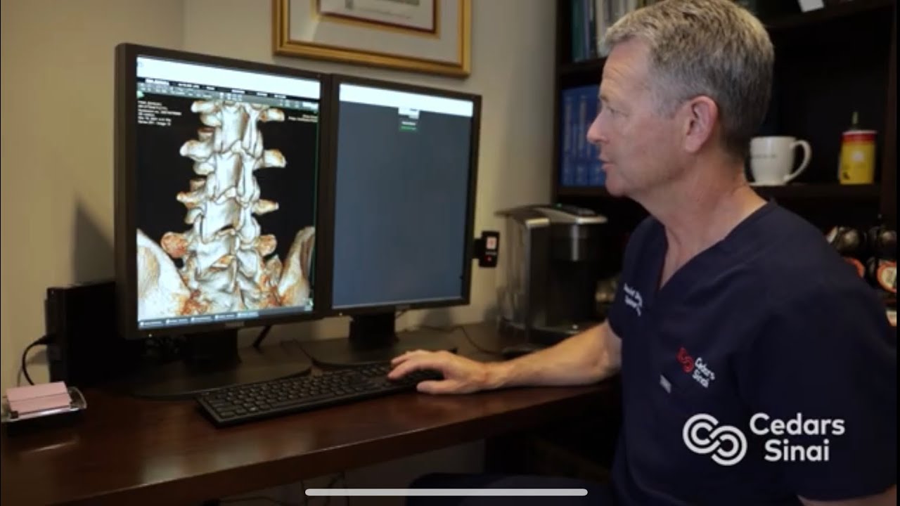 A Broken Spine Gone Undetected | Cedars-Sinai