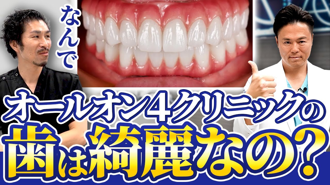 【大公開】なぜオールオン４クリニックの歯は綺麗なのか！