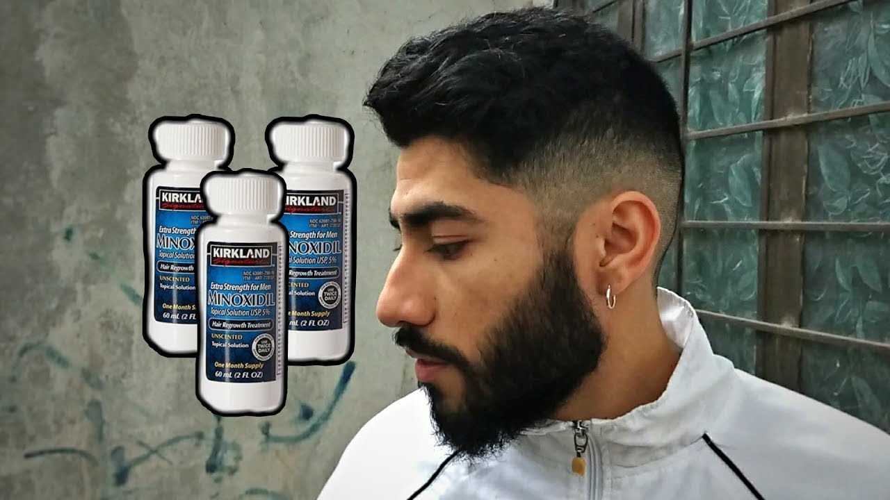 Cual es la Edad PERFECTA para usar Minoxidil en BARBA?