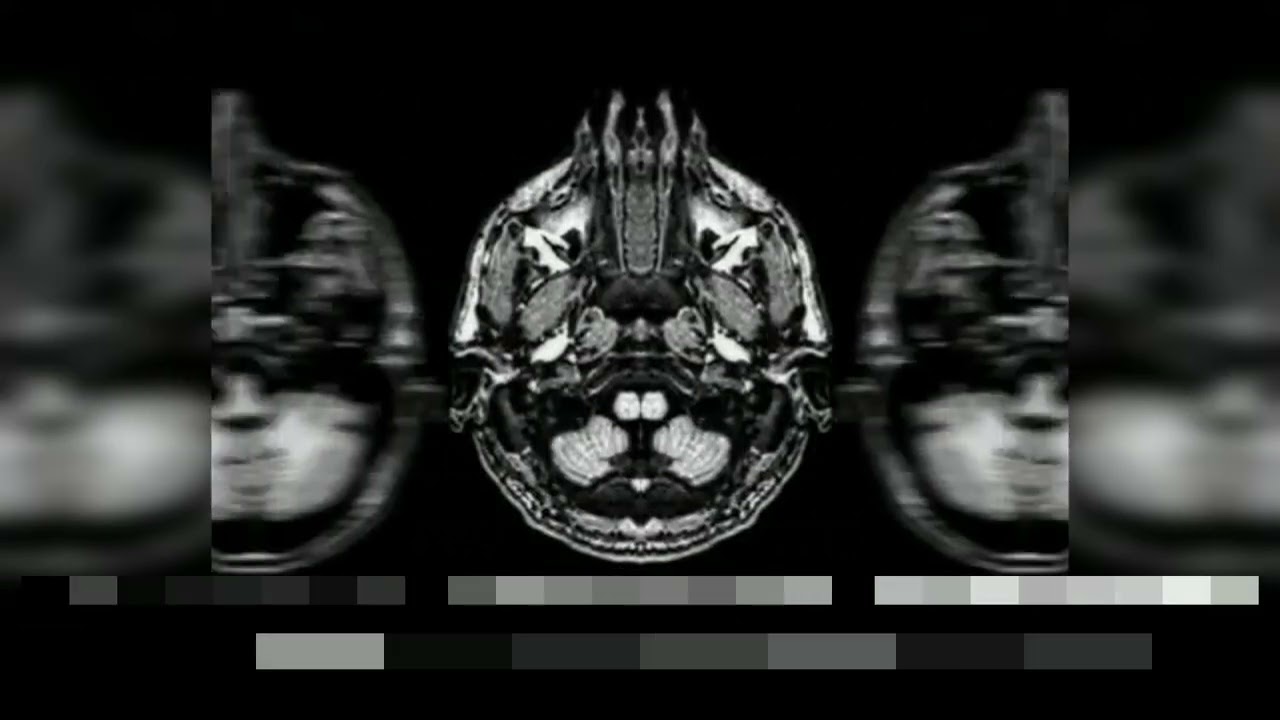 Neurochirurgie_2