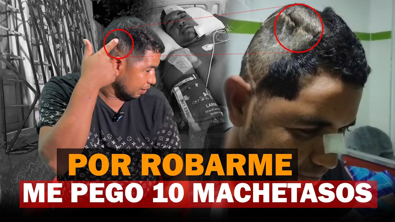 Me TENDIERON UNA TRAMPA y me PEGARON MÁS DE 10 MACHETAZOS - Caso del Mototaxista que esta vivo