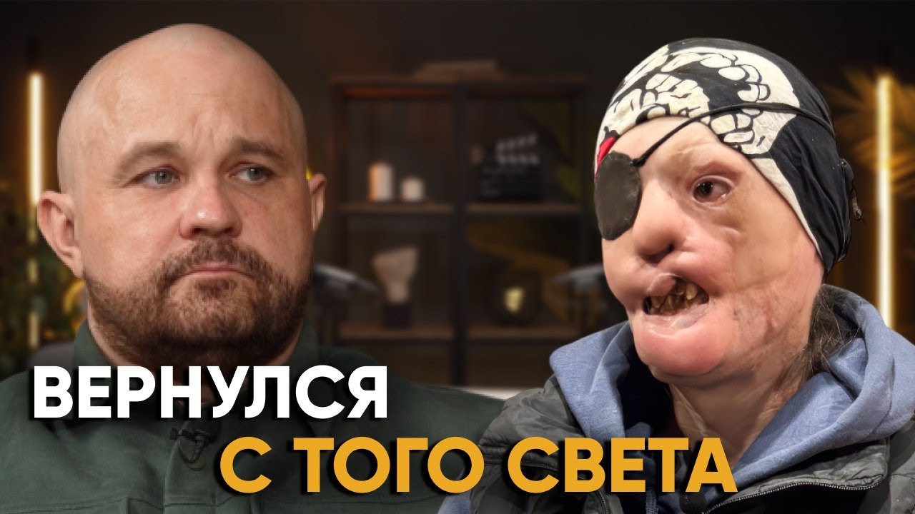 «Моя семья убрала все фото со мной». 30 ДНЕЙ КОМЫ, 15 ОПЕРАЦИЙ, ПОБЕГ В ДЕТДОМ И ТЮРЬМА.