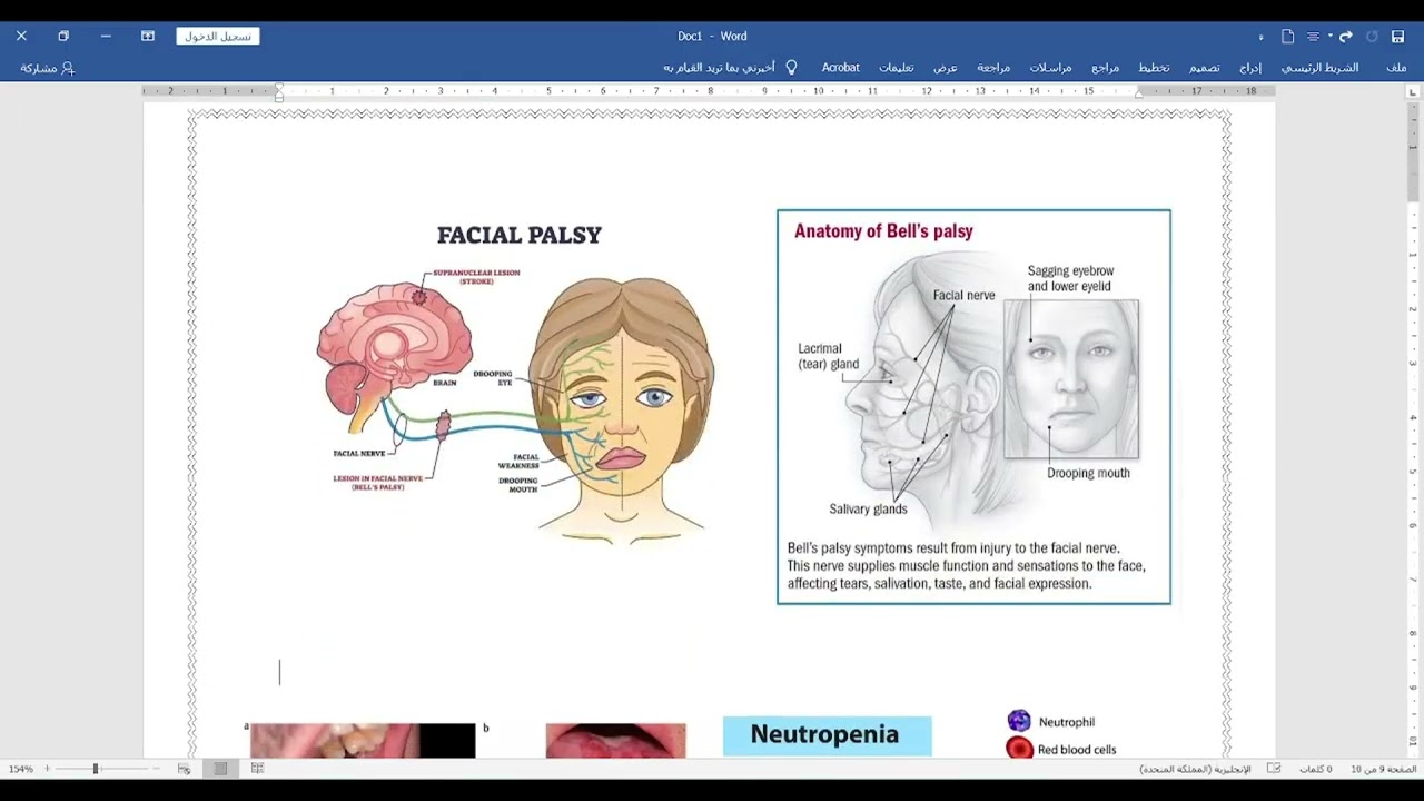 Hypertension part 2