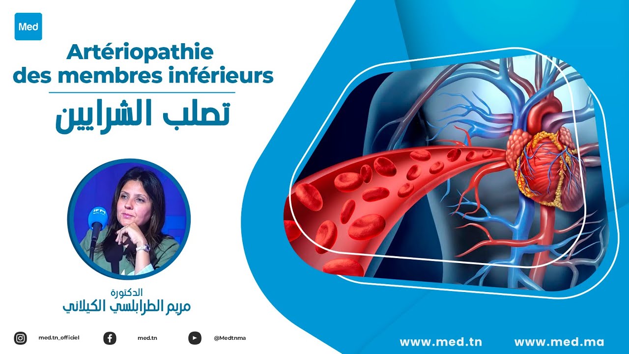 Dr Meriem Trabelsi Kilani - Artériopathie des membres inférieurs