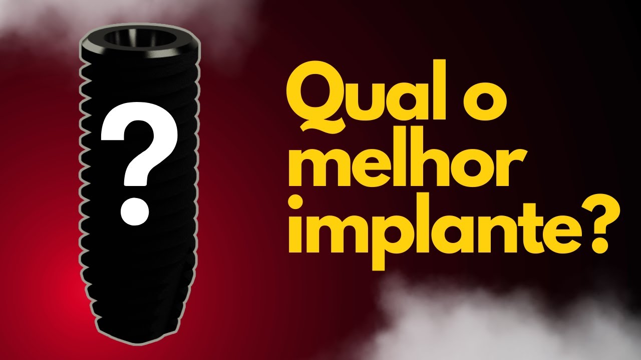 QUAL É O MELHOR IMPLANTE DENTÁRIO ?