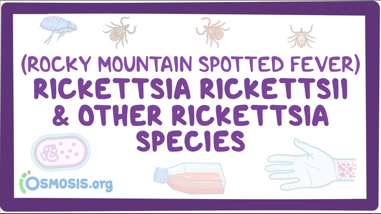 Rickettsia rickettsii & other Rickettsia species - an Osmosis Preview
