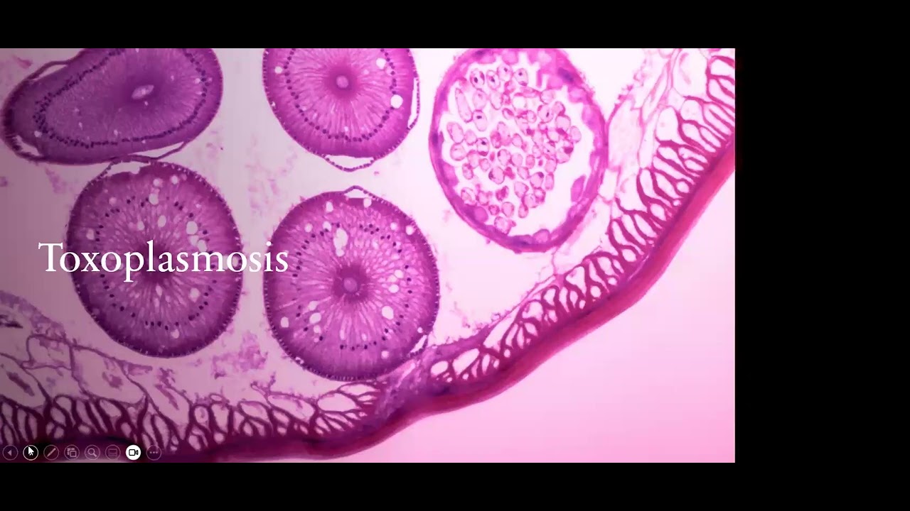 Enfermedades del TORCH 1era parte: Toxoplasma, Citomegalovirus y Rubeola