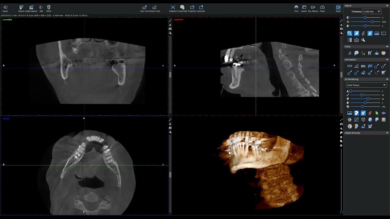 Step-by-Step Guide: Exporting CBCT Volumes to Dicom Using Planmeca Romexis
