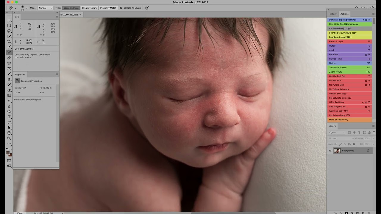 Editing Newborn Skin Acne