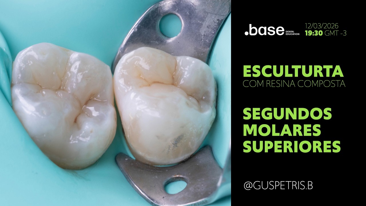 Escultura e Morfologia dos SEGUNDOS MOLARES SUPERIORES - com resina composta.