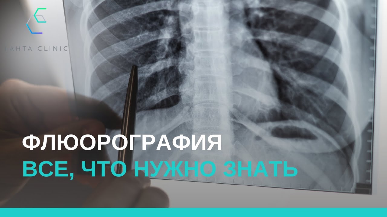 Флюорография &mdash; что вам нужно знать?