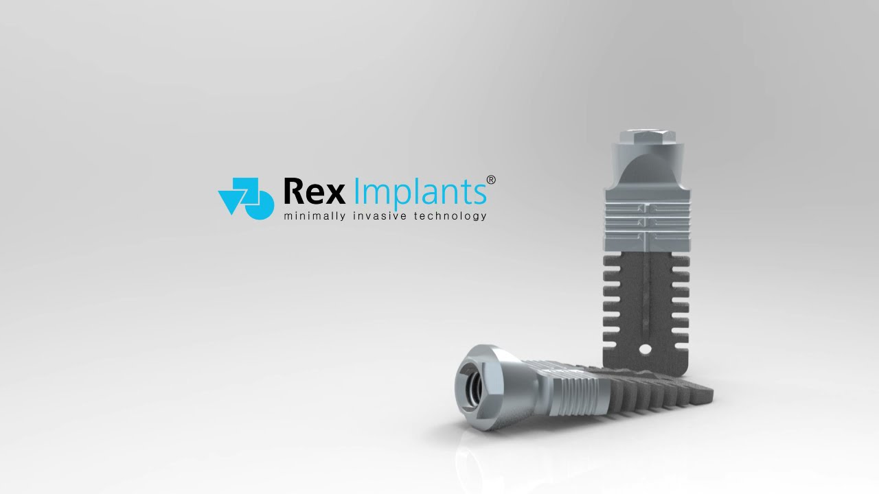 Rex Implants
