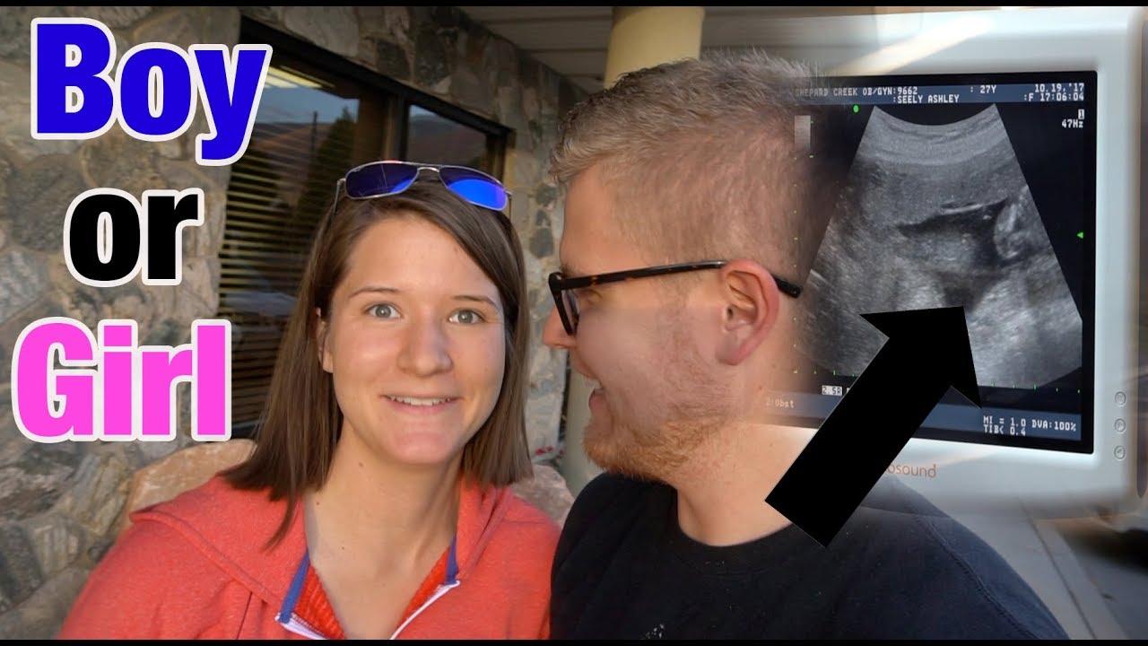 LIVE GENDER REVEAL 😂 Boy or Girl Ultrasound
