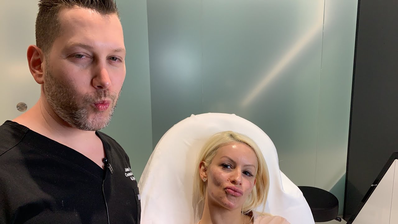 Female Facial Rejuvenation | Botox to Brows, Crow's Feet & Lip | West Hollywood, CA | Dr. Jason Emer