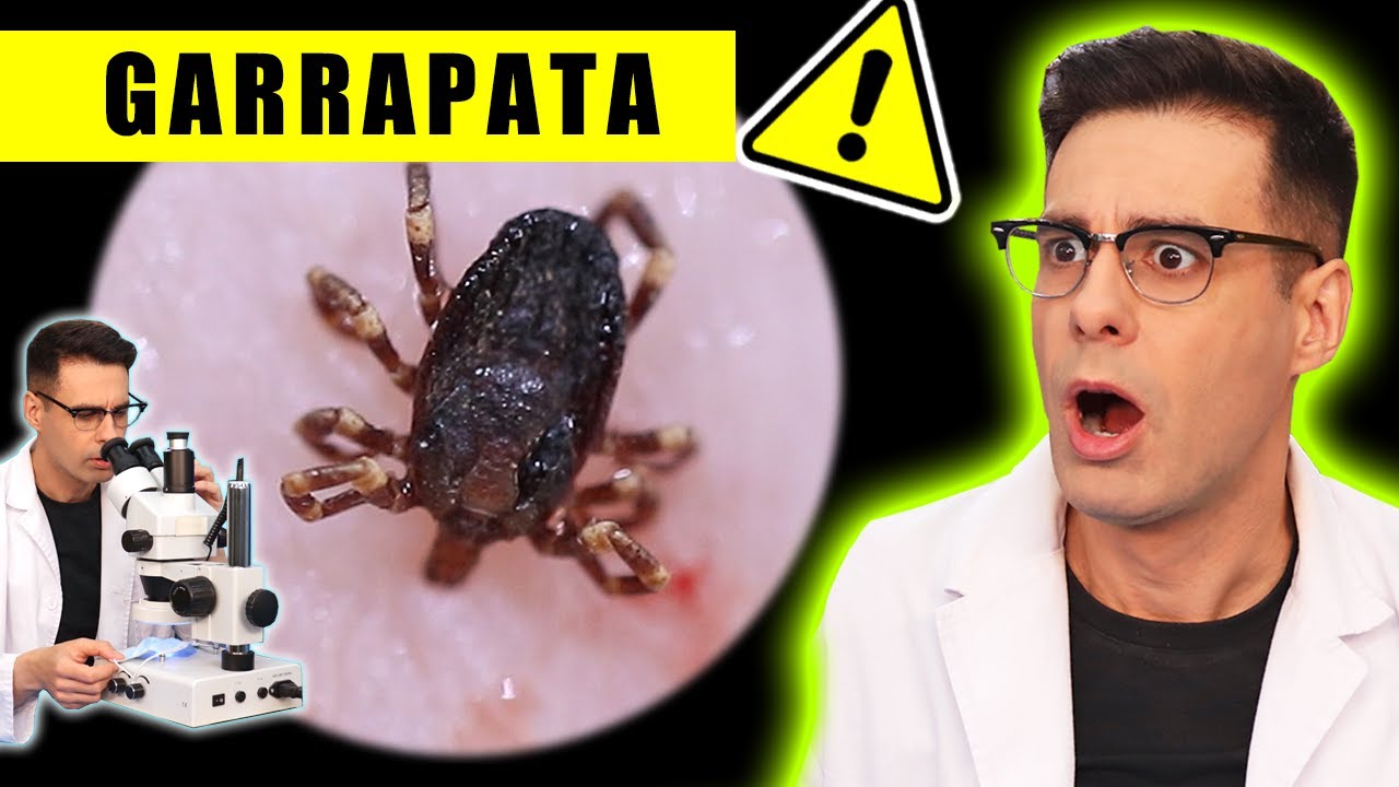 GARRAPATA Picando Bajo el Microscopio 😱 | Curiosidades con Mike