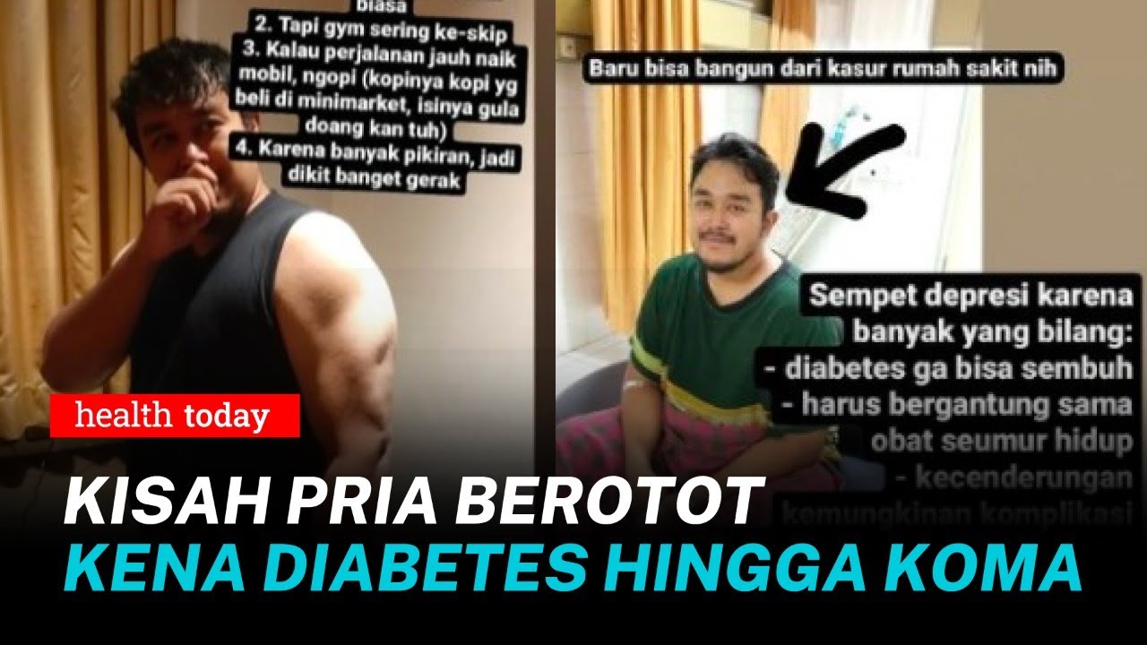 Viral! Pria Berotot Kena Diabetes Hingga Koma, Kenali Komplikasinya | Health Today 