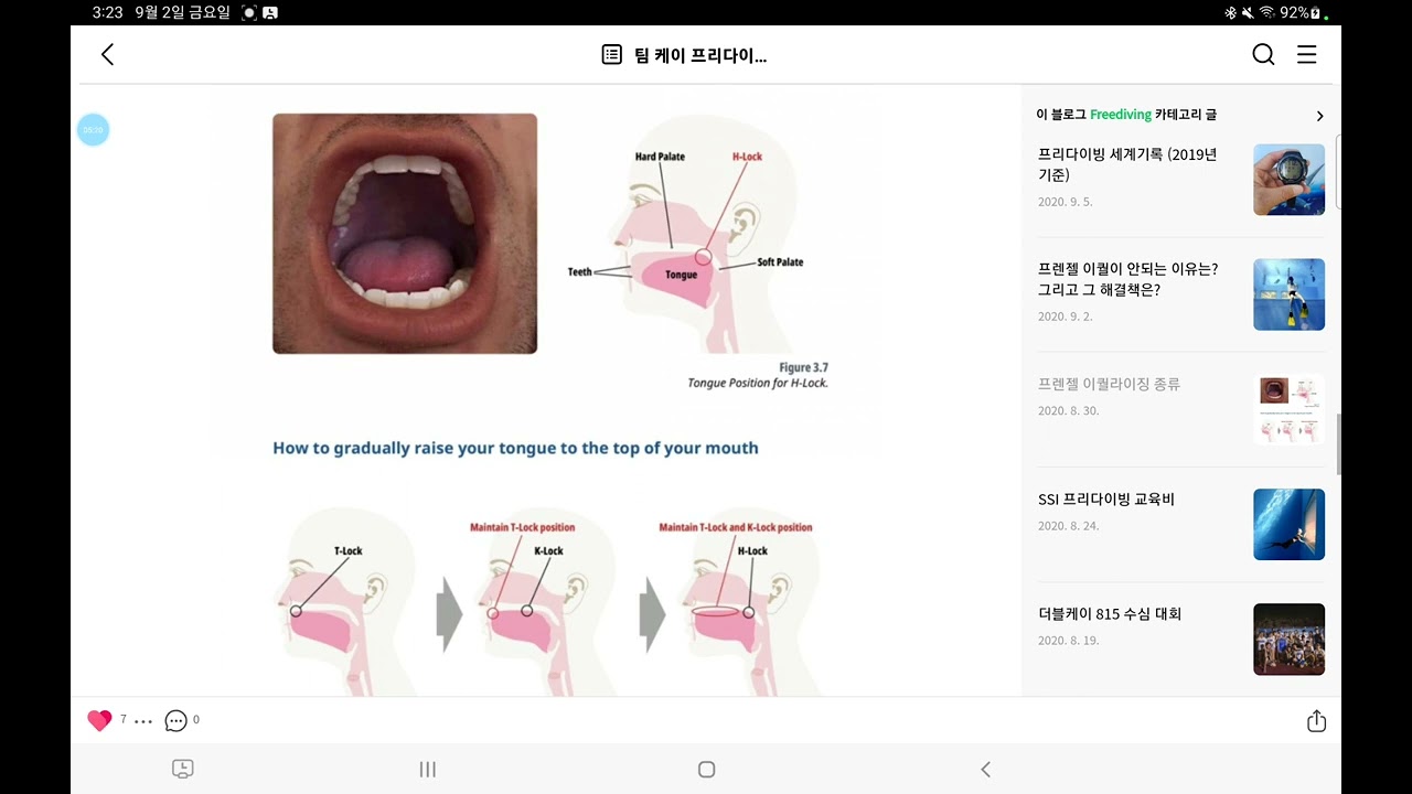 프렌젤 이퀄의 종류; traditional, advanced and sequential frenzel