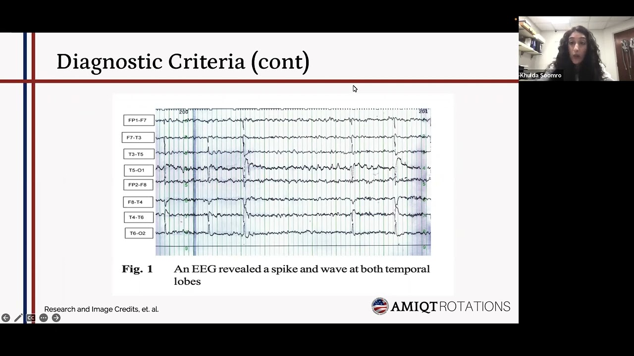AMIQT - Dr Kuhlda Soomro  Abdominal Epilepsy