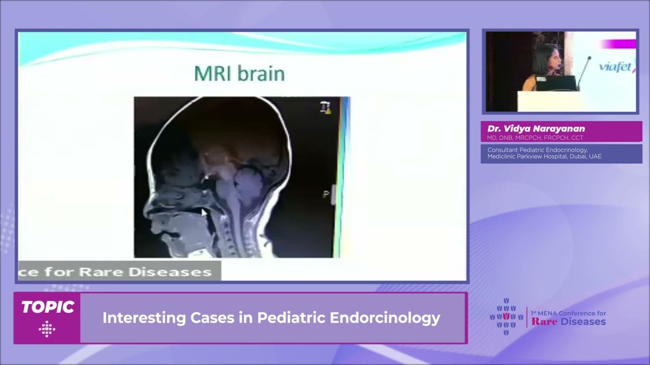 Dr. Vidya Narayanan : Interesting Cases in Pediatric Endocrinology