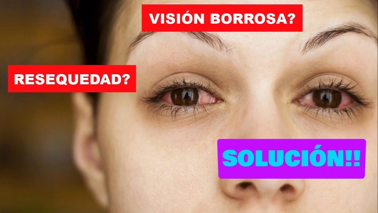 Acaba con la Visi&oacute;n Borrosa y la Resequedad en los Ojos de forma Natural