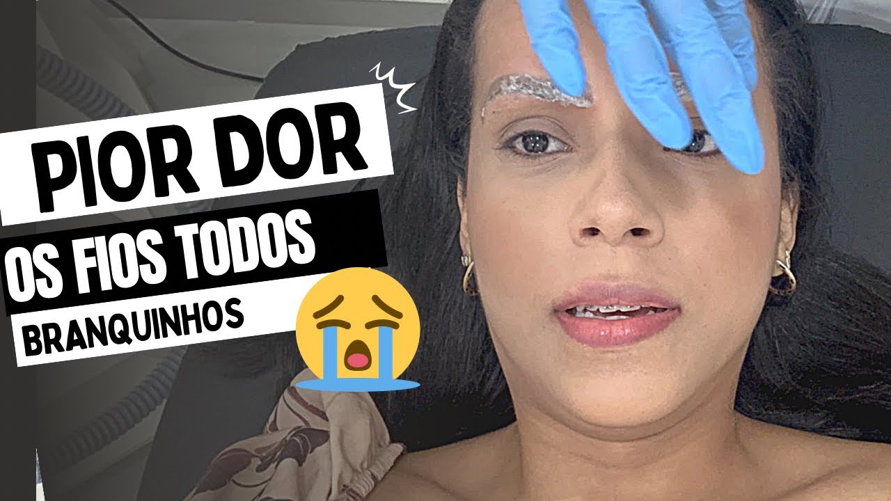 REMOVI MINHA MICROPIGMENTAÇÃO DE SOBRANCELHA, meu pós laser, dor, cuidados…