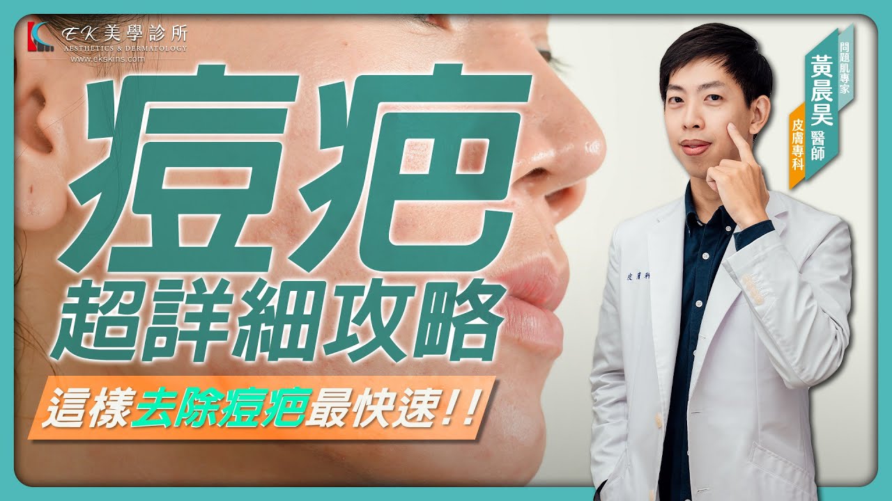 痘疤怎麼消最有效！？消除痘疤超詳細攻略！｜痘疤消除、淡化痘斑｜去痘疤、痘印、痘斑、紅痘疤｜黃晨昊皮膚專科醫師 &times; EK美學台中醫美診所