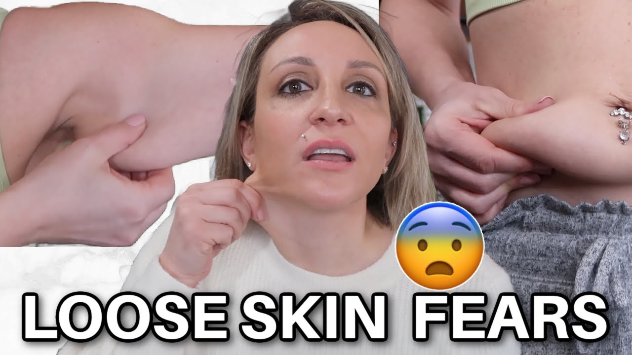 LOOSE SKIN after losing 65 lbs in 6.5 months | Ditch loose skin FEARS ASAP!