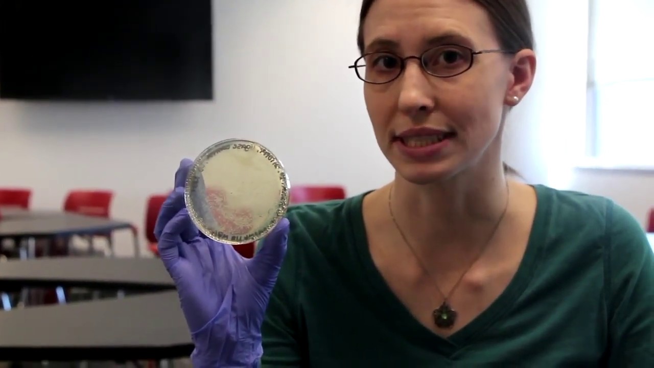 How to Count and Pick Colonies