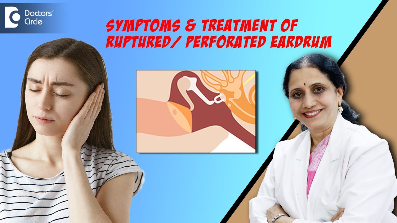 Perforated/Ruptured Eardrum -Causes & Treatment|Hole in the Ear -Dr.P Lakshmi Satish|Doctors' Circle