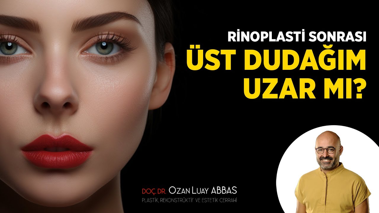 Rinoplasti Sonrası &Uuml;st Dudağım Uzar mı? | Do&ccedil;. Dr. Ozan Luay Abbas