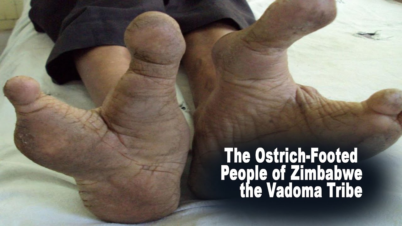 The Vadoma Tribe: The Mysterious Ostrich-Footed People of Zimbabwe
