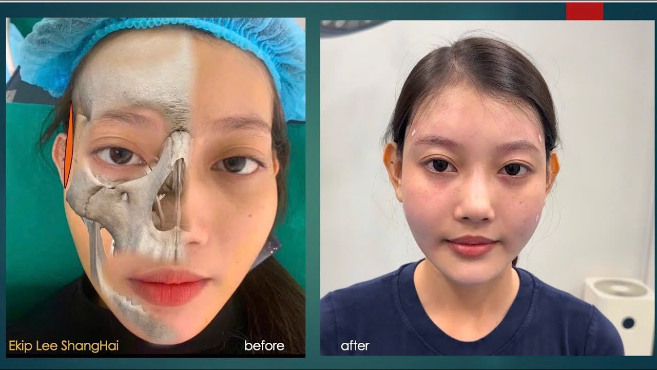 Chủ đề mặt lệch b&agrave;i 1 #kiếnthức #thẩmmỹ #chiasekinhnghiem #congailamdep #xuhuongyoutube