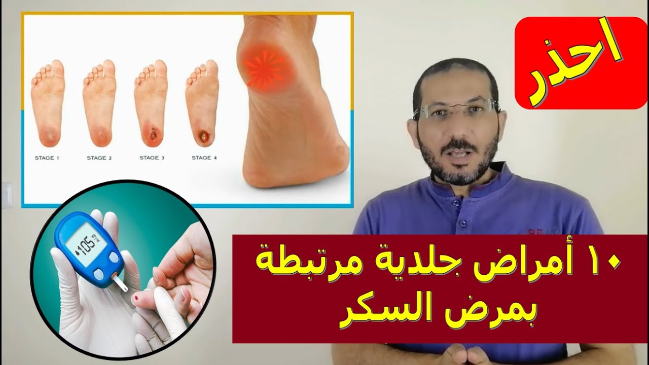 ⚠️احذر ١٠ أمراض جلدية مرتبطة بمرض السكر👌 👍