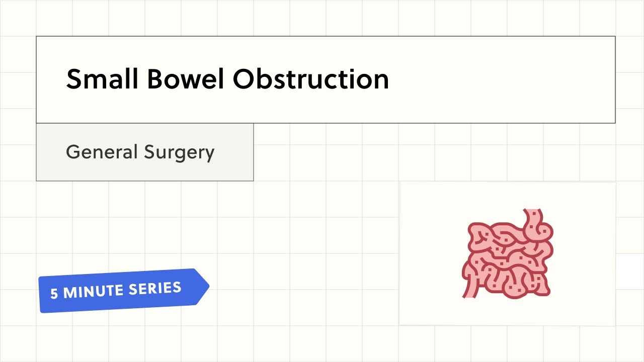 Small Bowel Obstruction (5-Minute Clinical Summary)