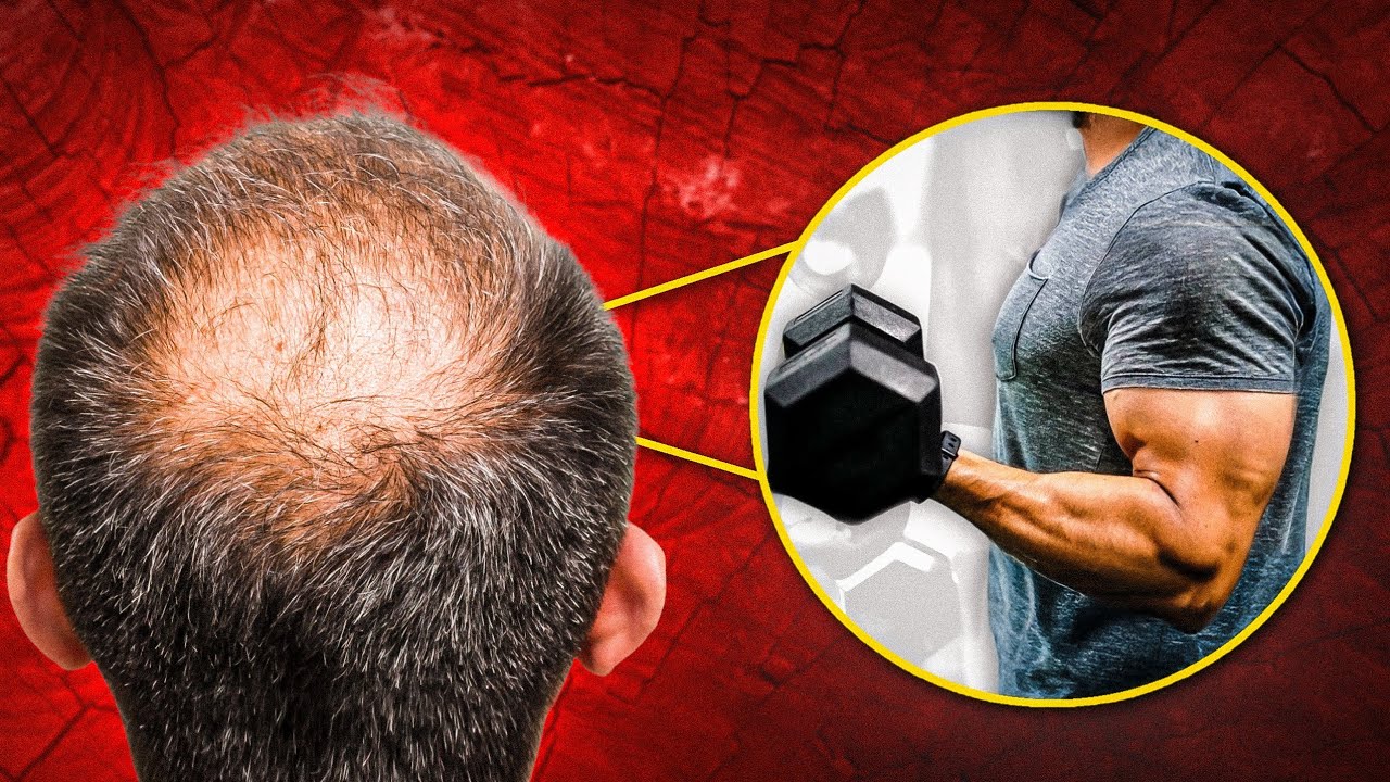 5 WORST Mistakes DESTROYING Your Hair And Making You BALD (Kadwa Sach)