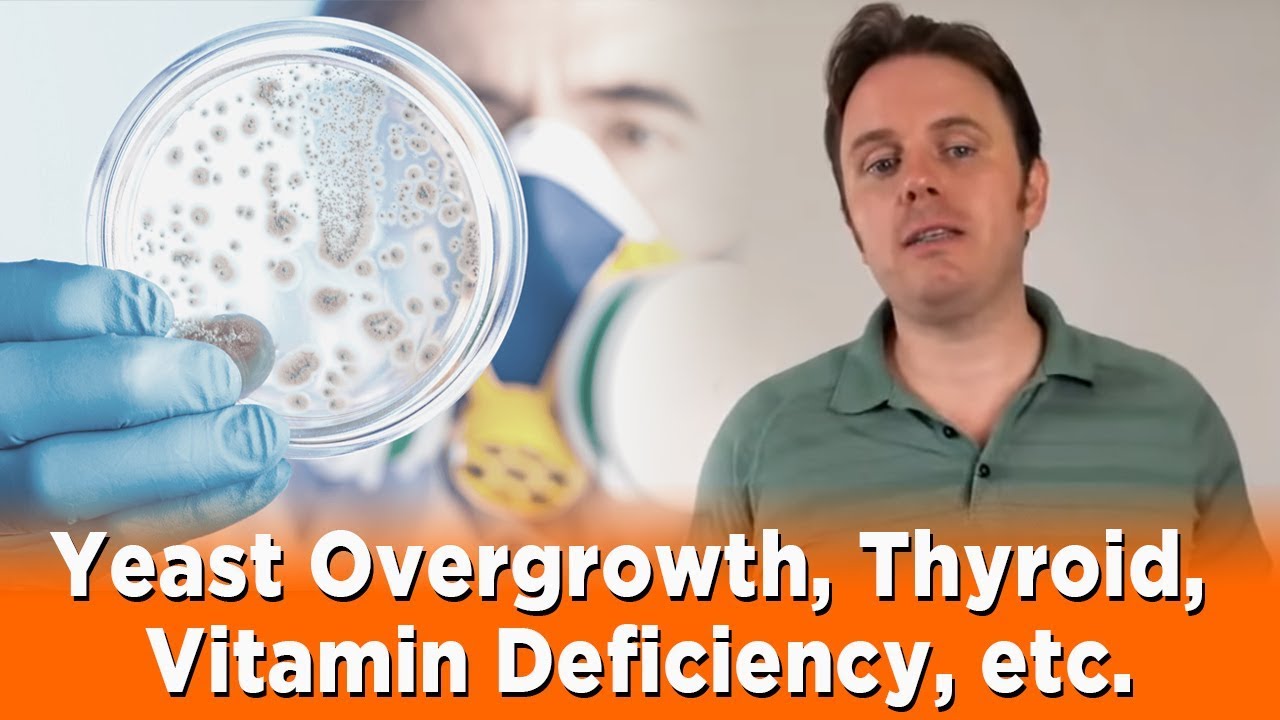 Yeast Overgrowth, Thyroid-stimulating Hormone, Vitamin Deficiency, etc. | Dr. J Q & A