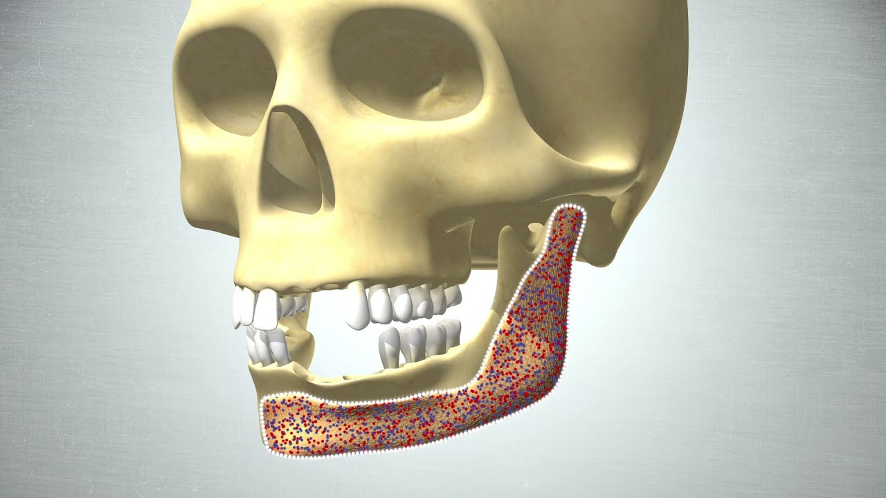 Revolution in Bone Regeneration