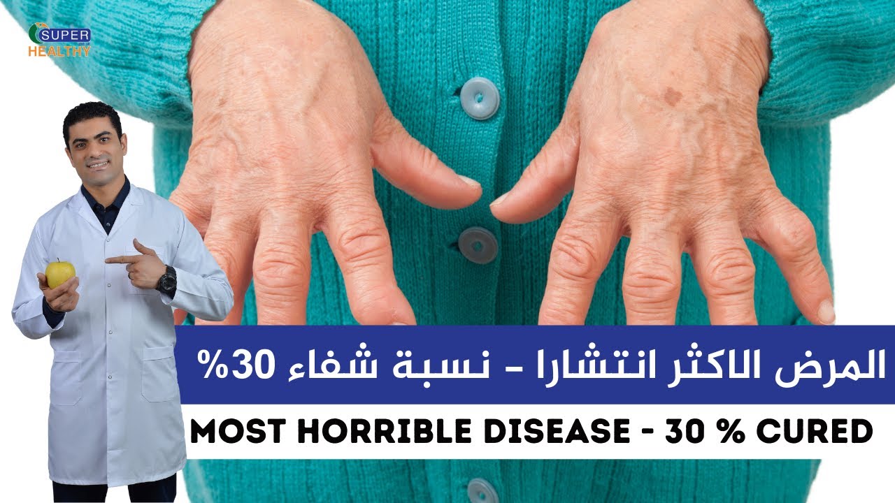 #الروماتويد  طريقة العلاج بالتغذية العلاجية |  How to treat #rheumatoid  using Nutritional therapy