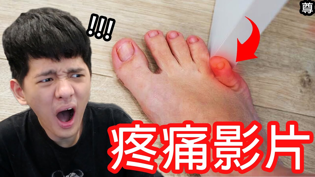 【尊】所有你能想到的疼痛都在這個影片裡...【第2頻道】