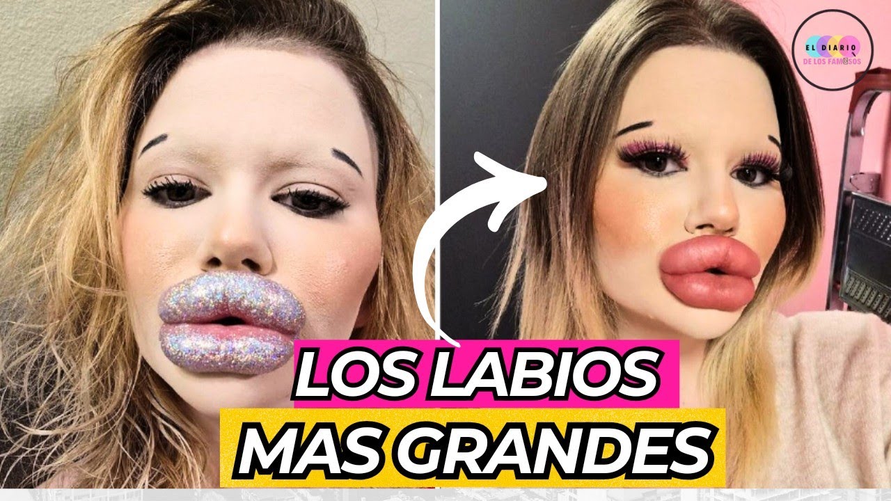 LA MUJER CON LOS LABIOS MAS GRANDES DEL MUNDO|  NO LO PODRAS CREER | Viral | Noticias |