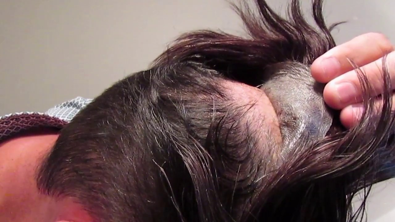Hair Replacement Mens Hair System Review  Poly thin skin Final Review!!