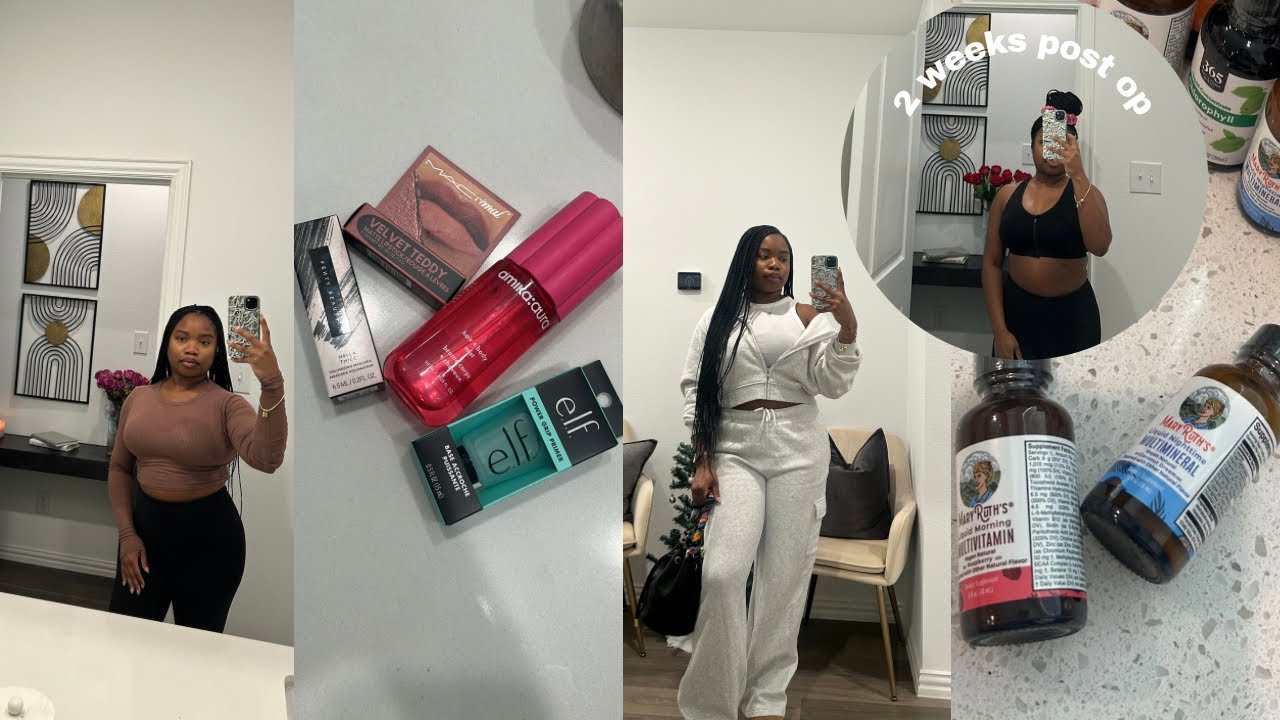 I Finally Saw My Scars… 2 Weeks Post-Op | Healing + Life Update