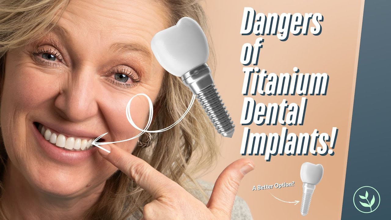 WARNING: The Hidden Dangers of Titanium Dental Implants!